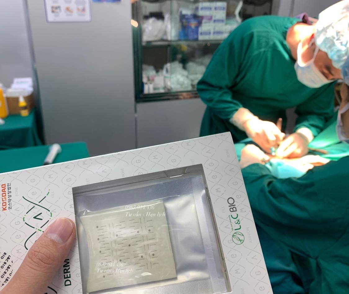 Megaderm: Miếng độn sinh học hàng đầu từ Hàn Quốc