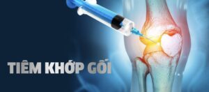 Dịch nhờn khớp gối Singjoint 30mg/2.5ml