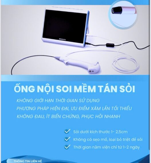 Ống nội soi mềm Scivita là gì?
